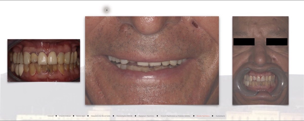 Initial clinical condition