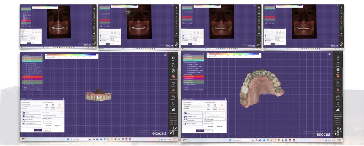 Digital smile assessment